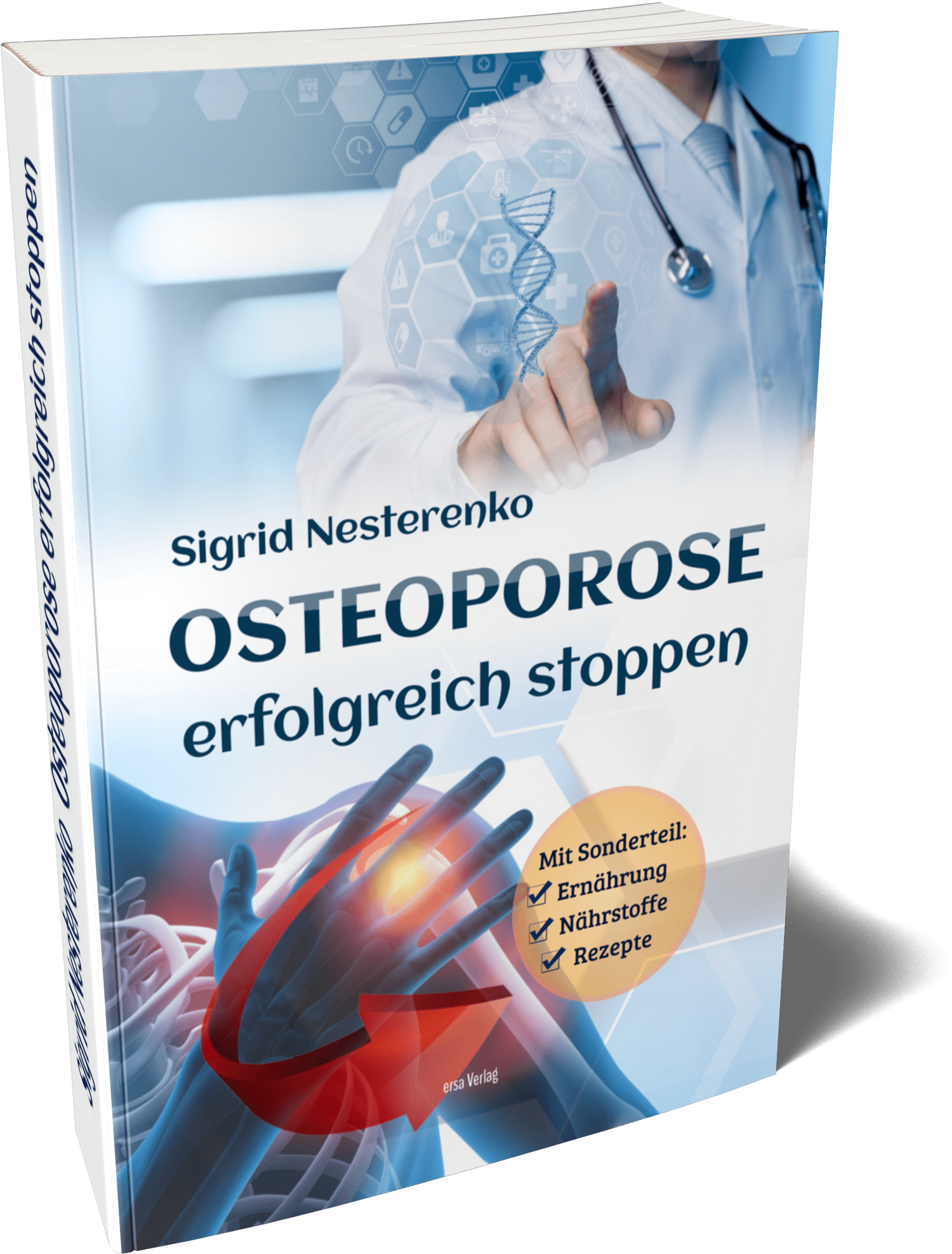 Osteoporose